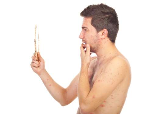 ES CONTAGIOSA LA CULEBRILLA