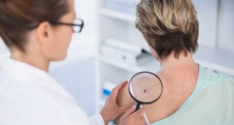 Dermatologist examining mole of female patient with magnifying glass in clinic