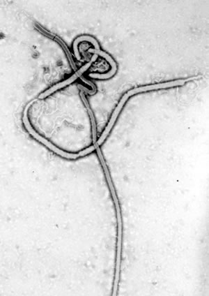 Virus del Ebola