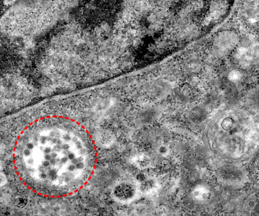 Científicos en Brasil captan el momento cuando el Coronavirus infecta una célula sana