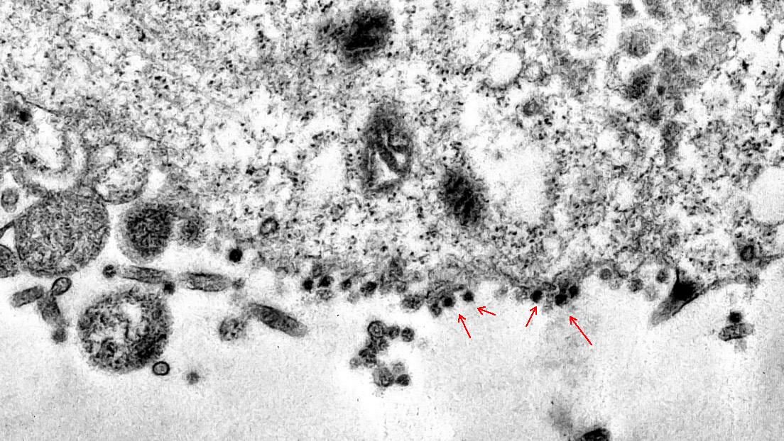 Científicos en Brasil captan el momento cuando el Coronavirus infecta una célula sana (1)
