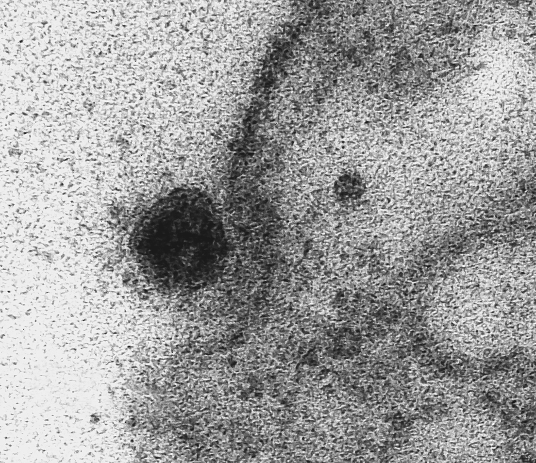 Científicos en Brasil captan el momento cuando el Coronavirus infecta una célula sana