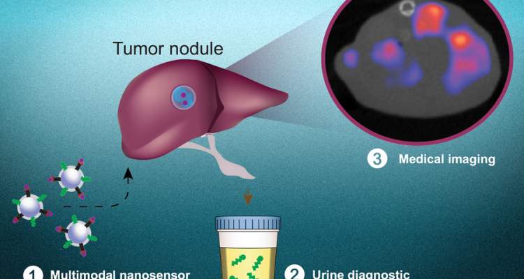 Nueva técnica no invasiva para detectar el cáncer desarrollada por el MIT