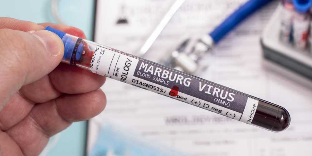 La OMS alerta sobre brote de virus Marburgo en Tanzania
