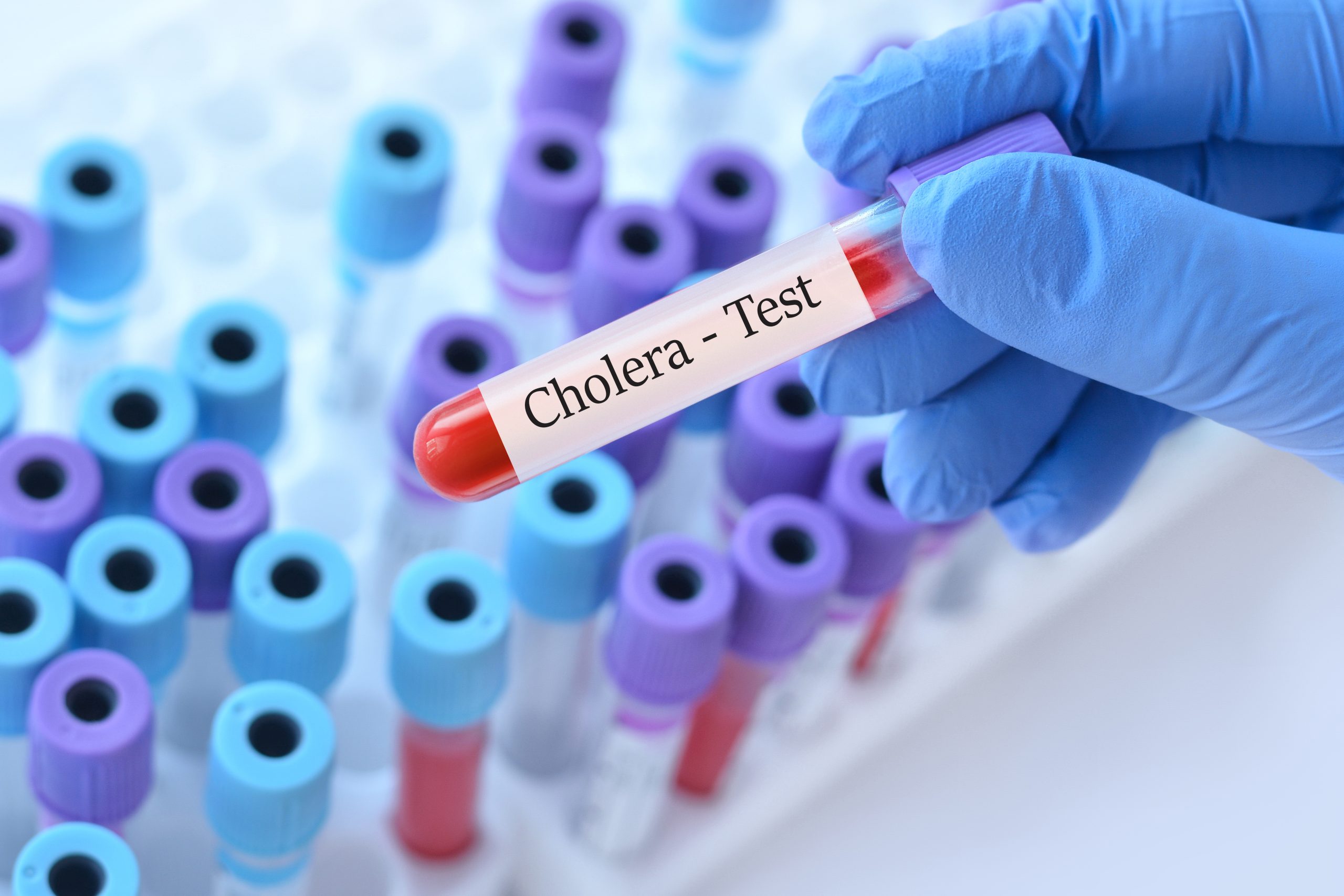 Doctor holding a test blood sample tube with Cholera test on the background of medical test tubes with analyzes.