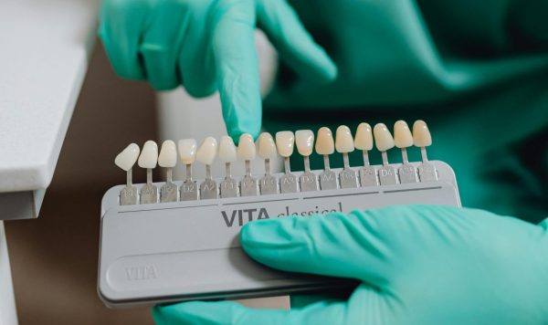 implantes dentales, coronas dentales, ortodoncia, endodoncia, diastema, blanqueamientos dentales, control de enfermedades como las periodontales ODONTOLOGÍA