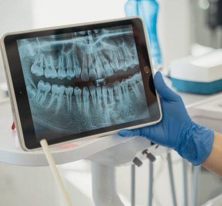Control de enfermedades como las periodontales Control de enfermedades como las periodontales