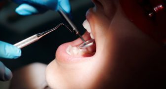 ODONTOLOGÍA CUIDADO DENTAL CARILLAS DENTALES