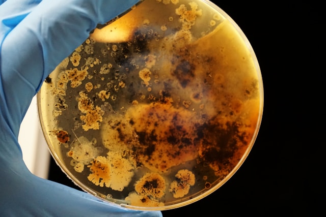 CULTIVO DE BACTERIAS RESISTENTES A ANTIOBIOTICOS