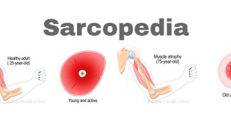 SUPLEMENTOS Y VITAMINAS PARA LA PERDIDA MUSCULAR sarcopedia
