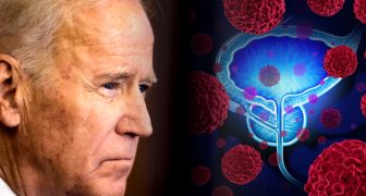 Joe Biden tiene cáncer de próstata Grado 9 con metástasis ósea